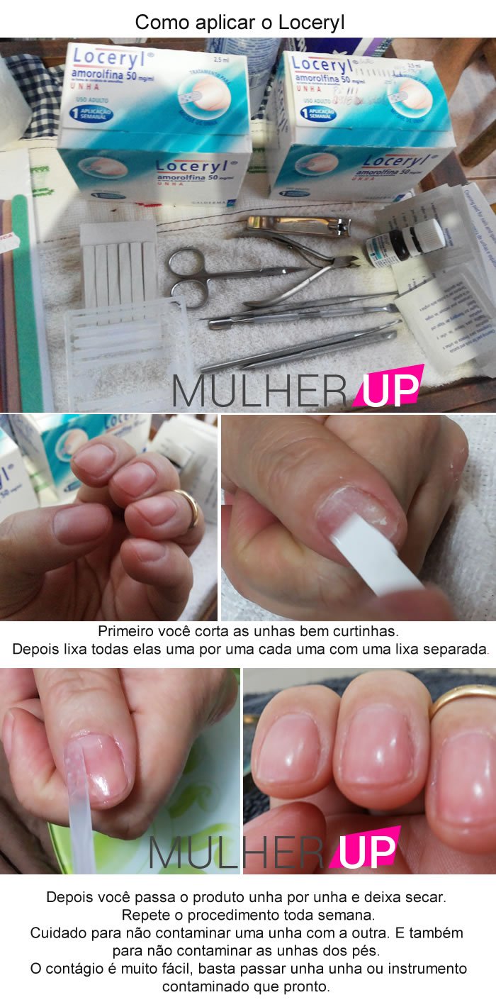 como-aplicar-loceryl-nas-unhas-com-micose