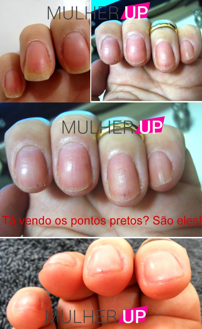 minhas-unhas-depois-das-micoses